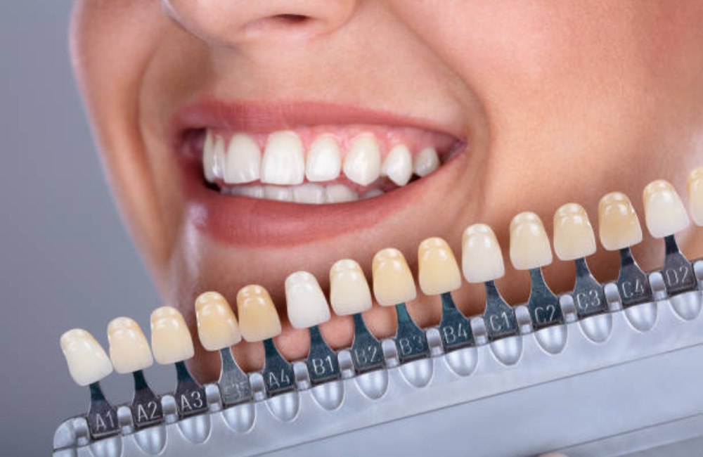 Adult dentistry in Rosarito Beach